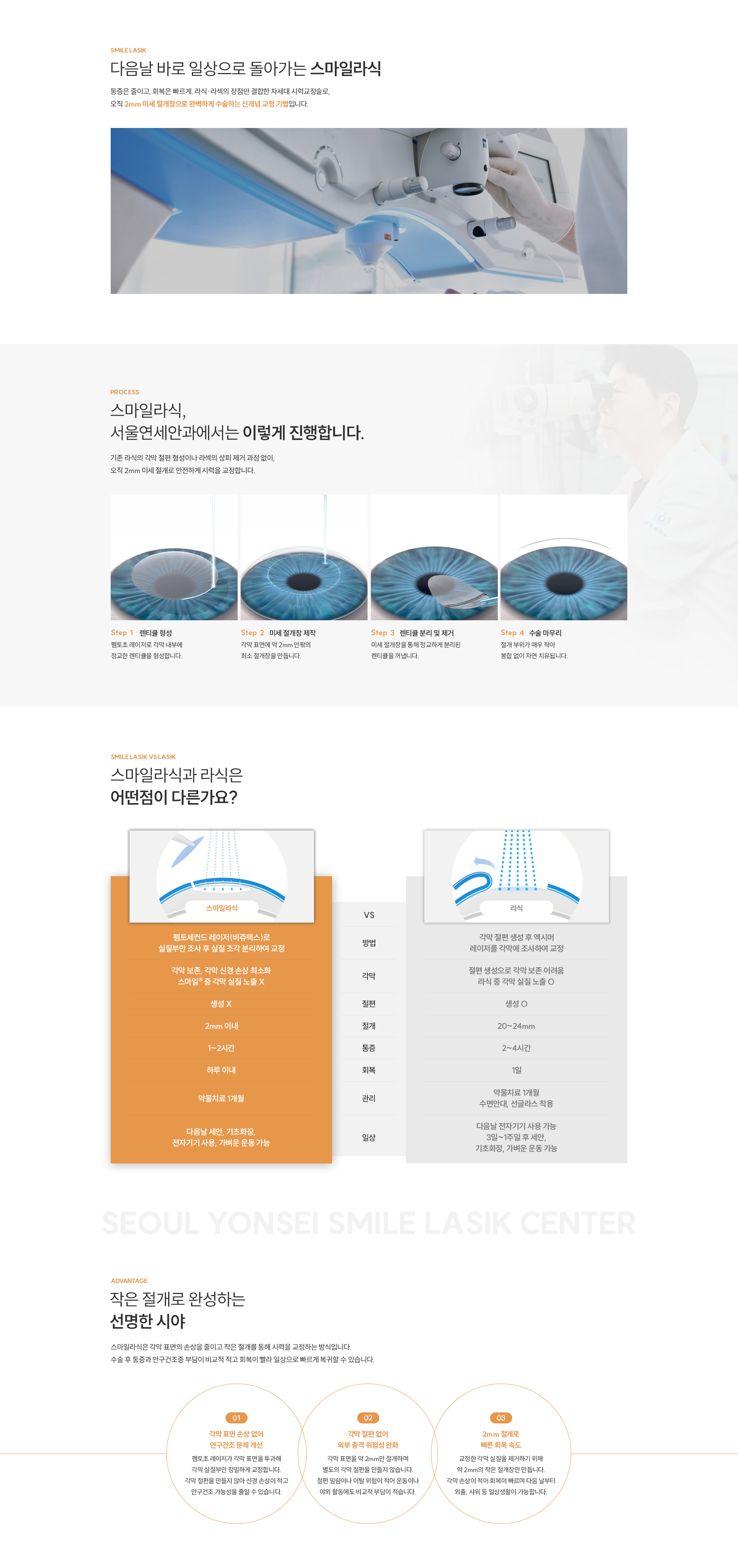 스마일라식 수술