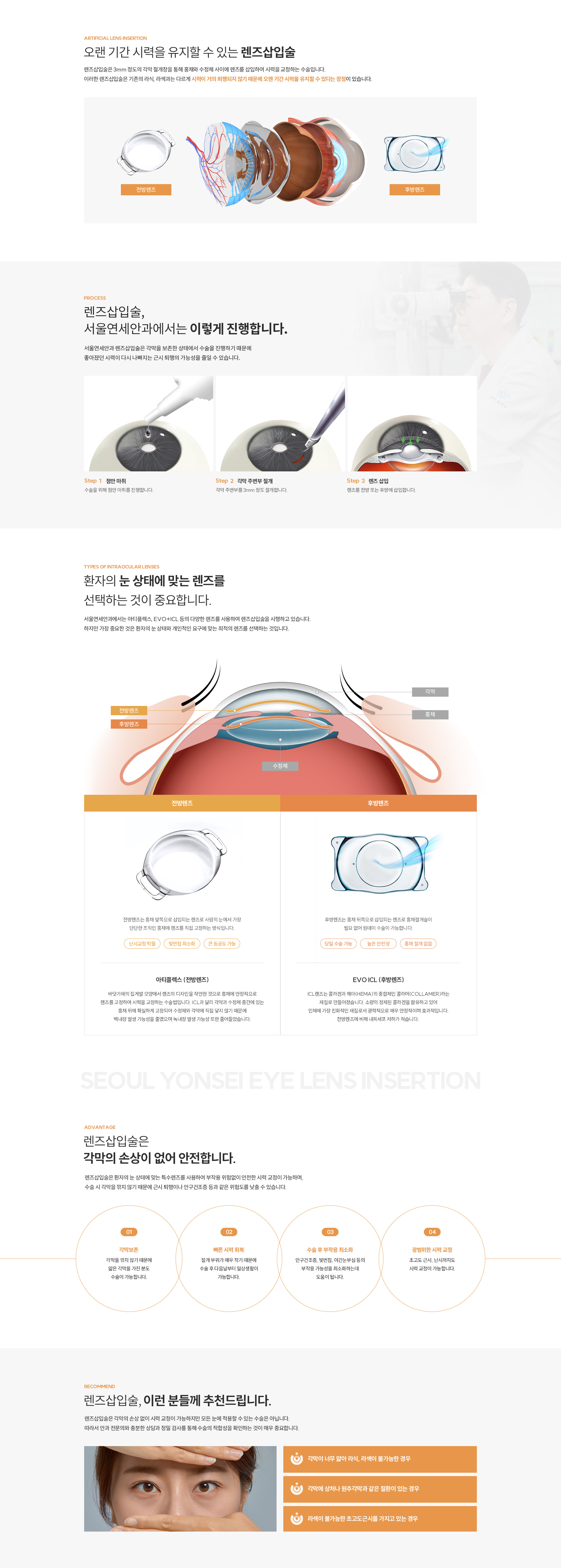 렌즈삽입술