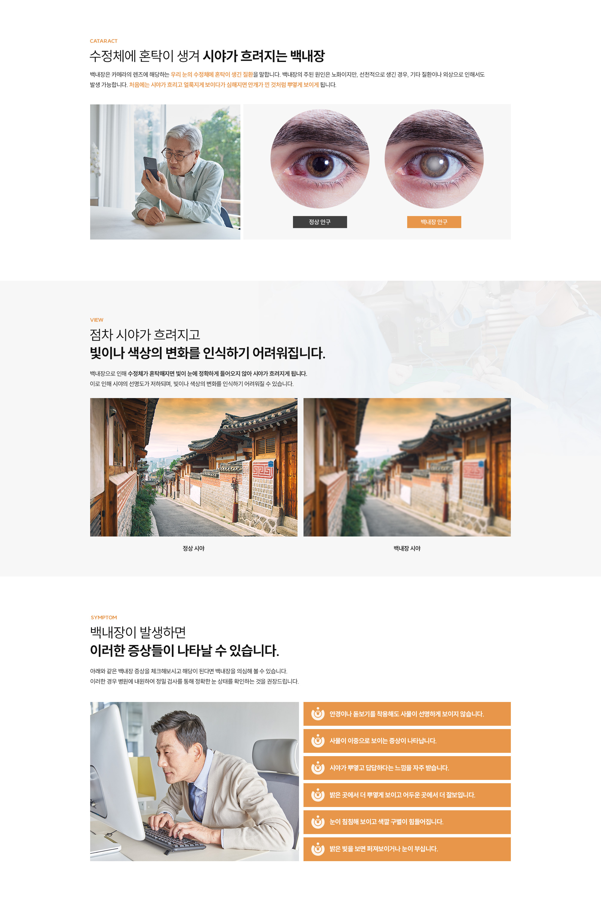 백내장