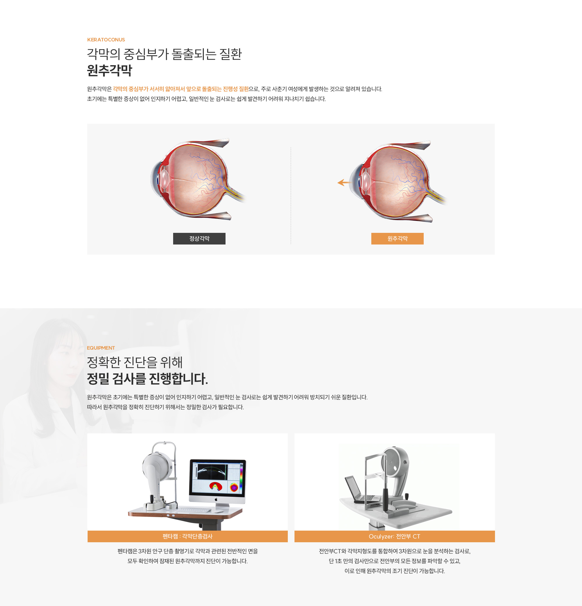 원추각막