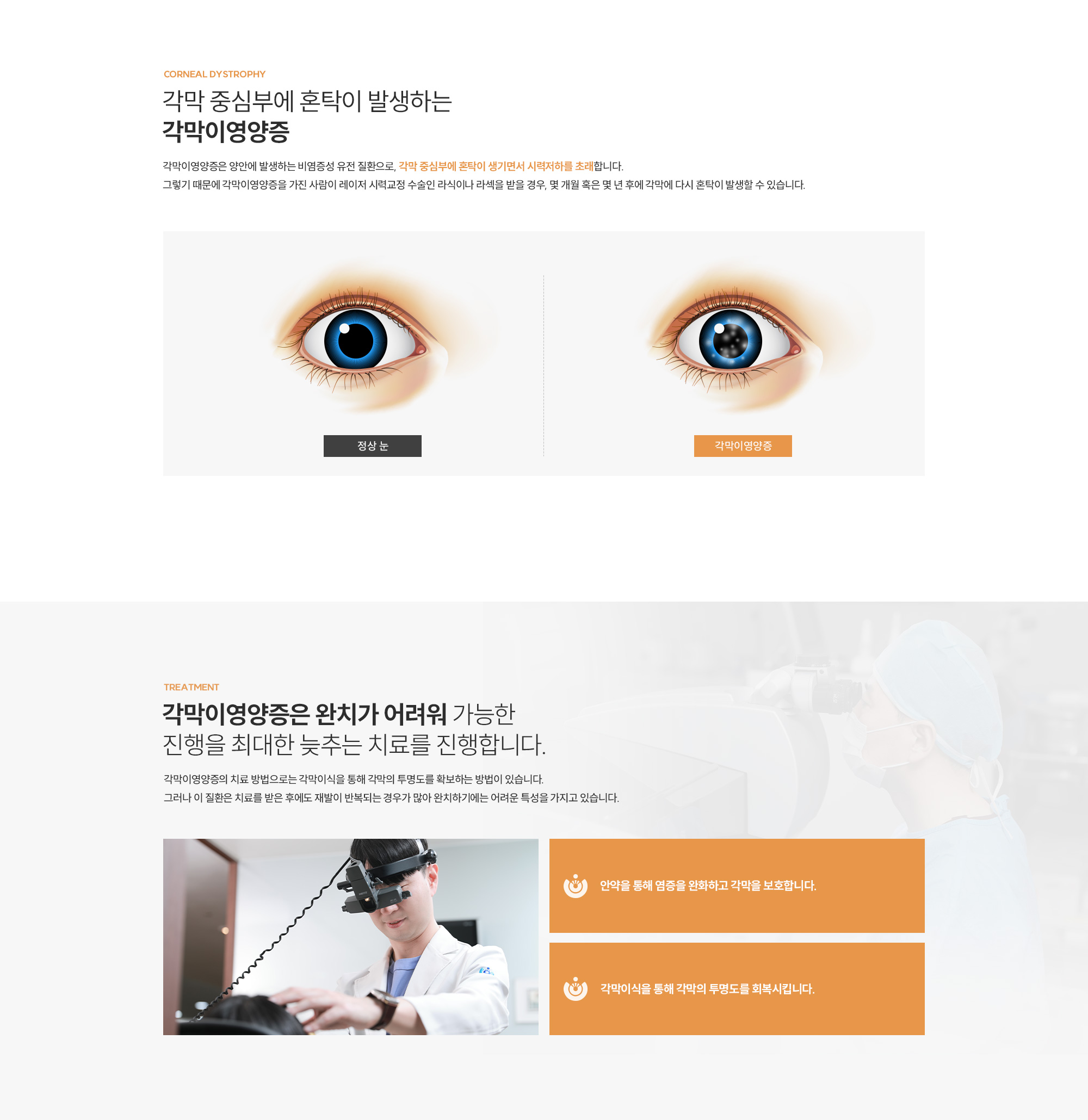 각막이여양증