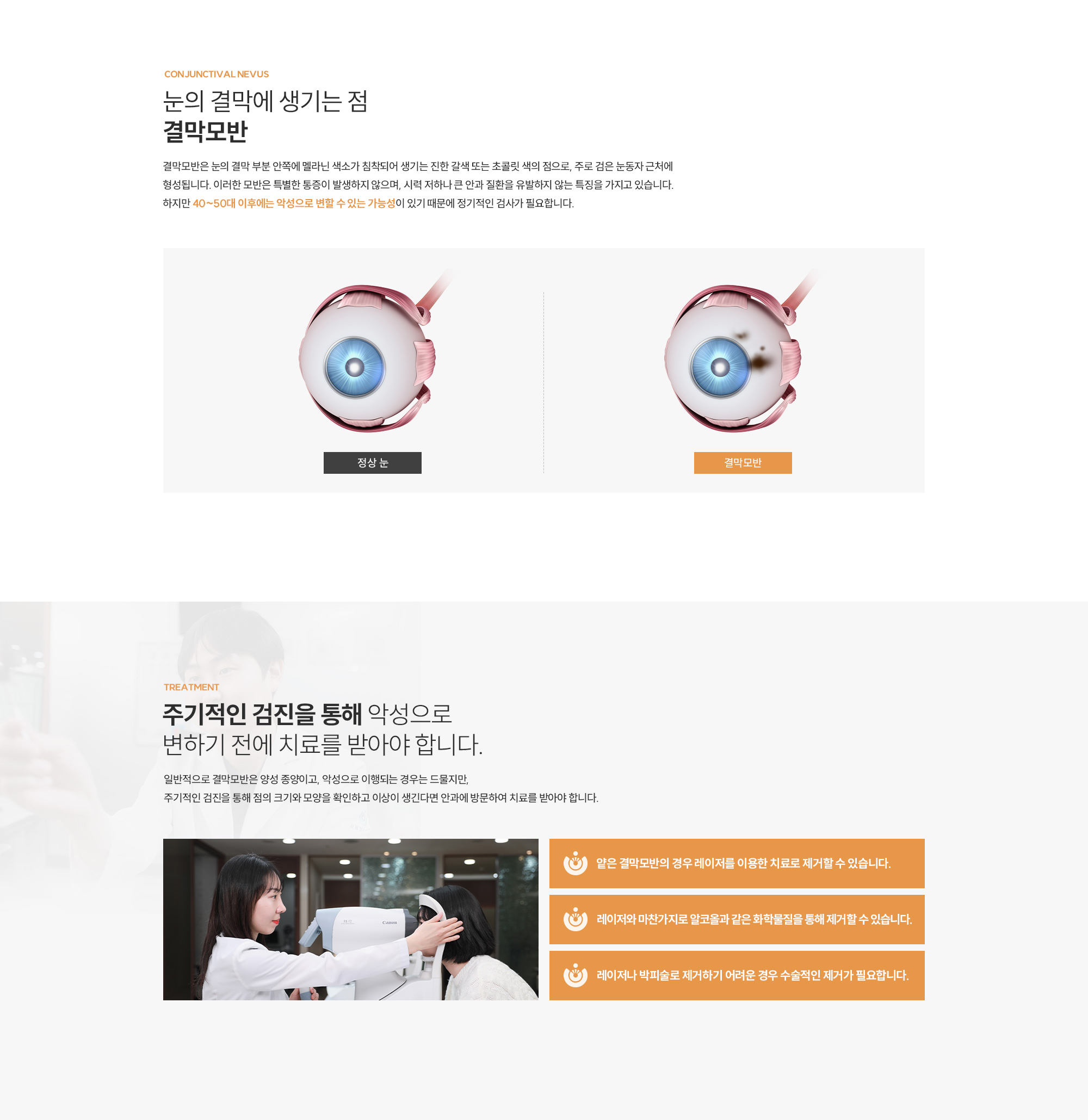 결막모반