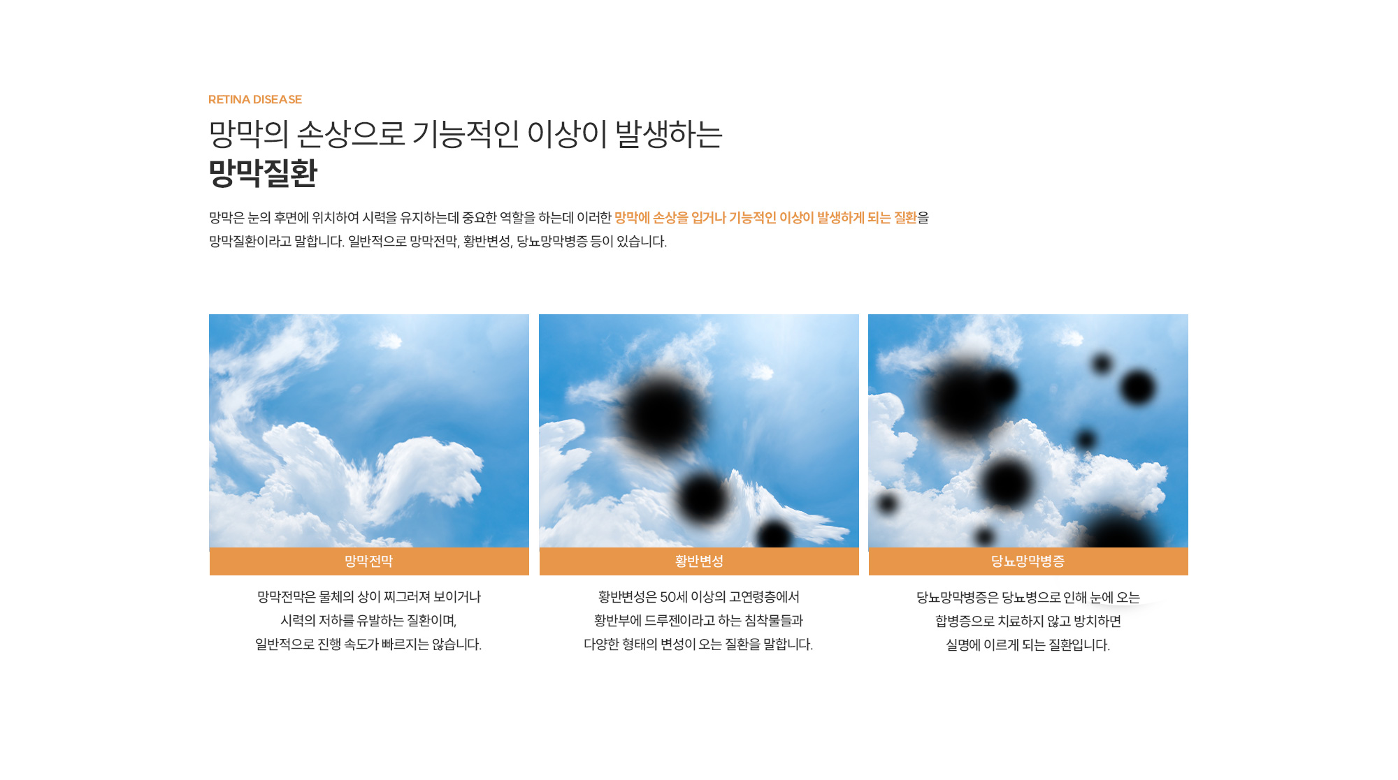 망막질환